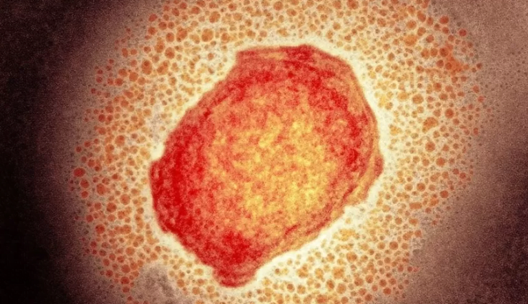 varíola dos macacos