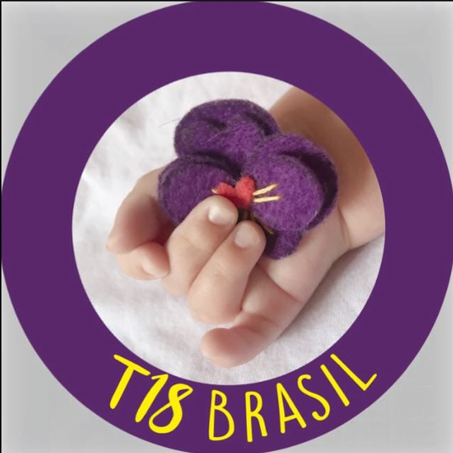 síndrome de edwards