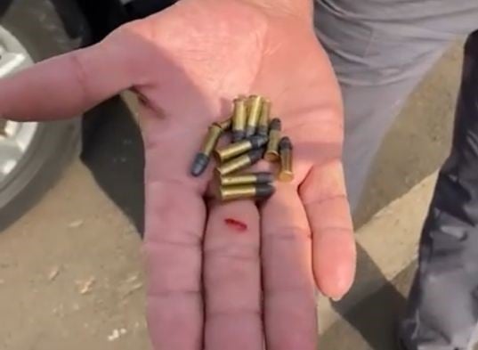 Projéteis Catador de recicláveis é baleado após ter sido confundido com ladrão em Limeira