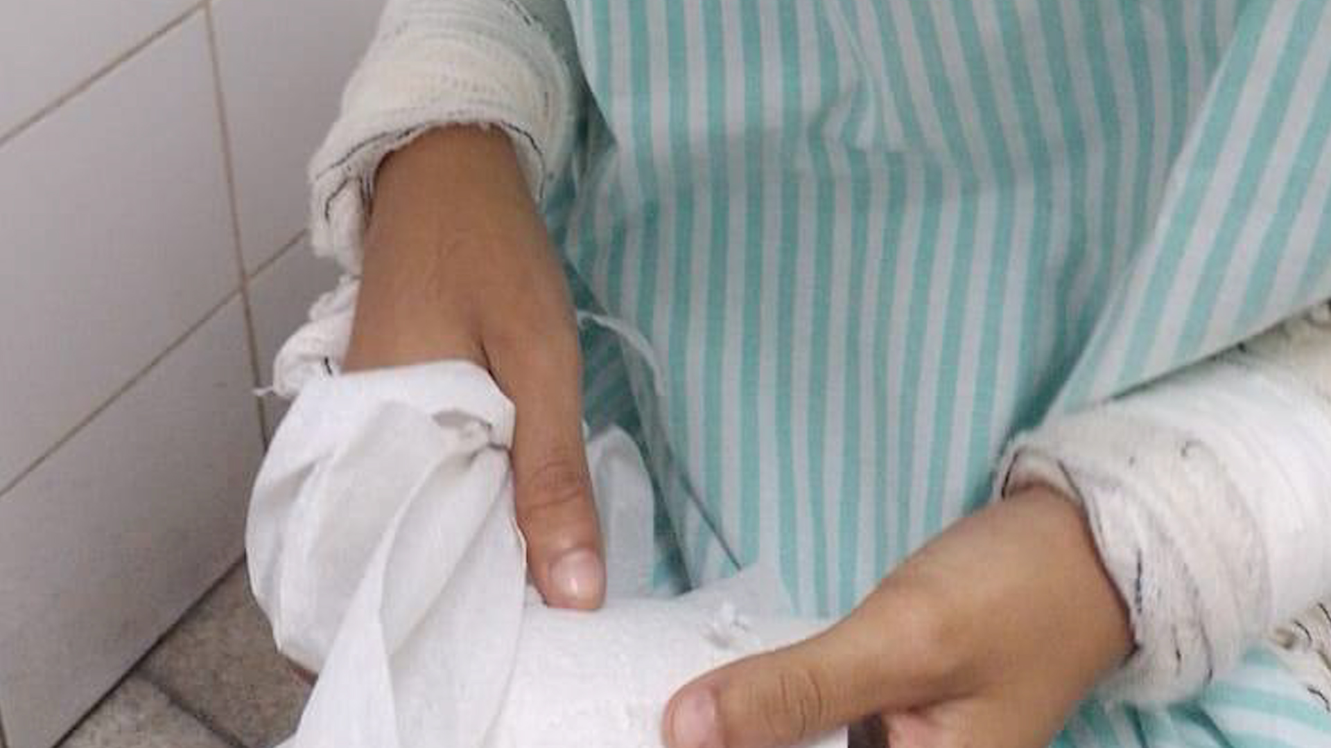 Jovem é brutalmente agredida por ciúme