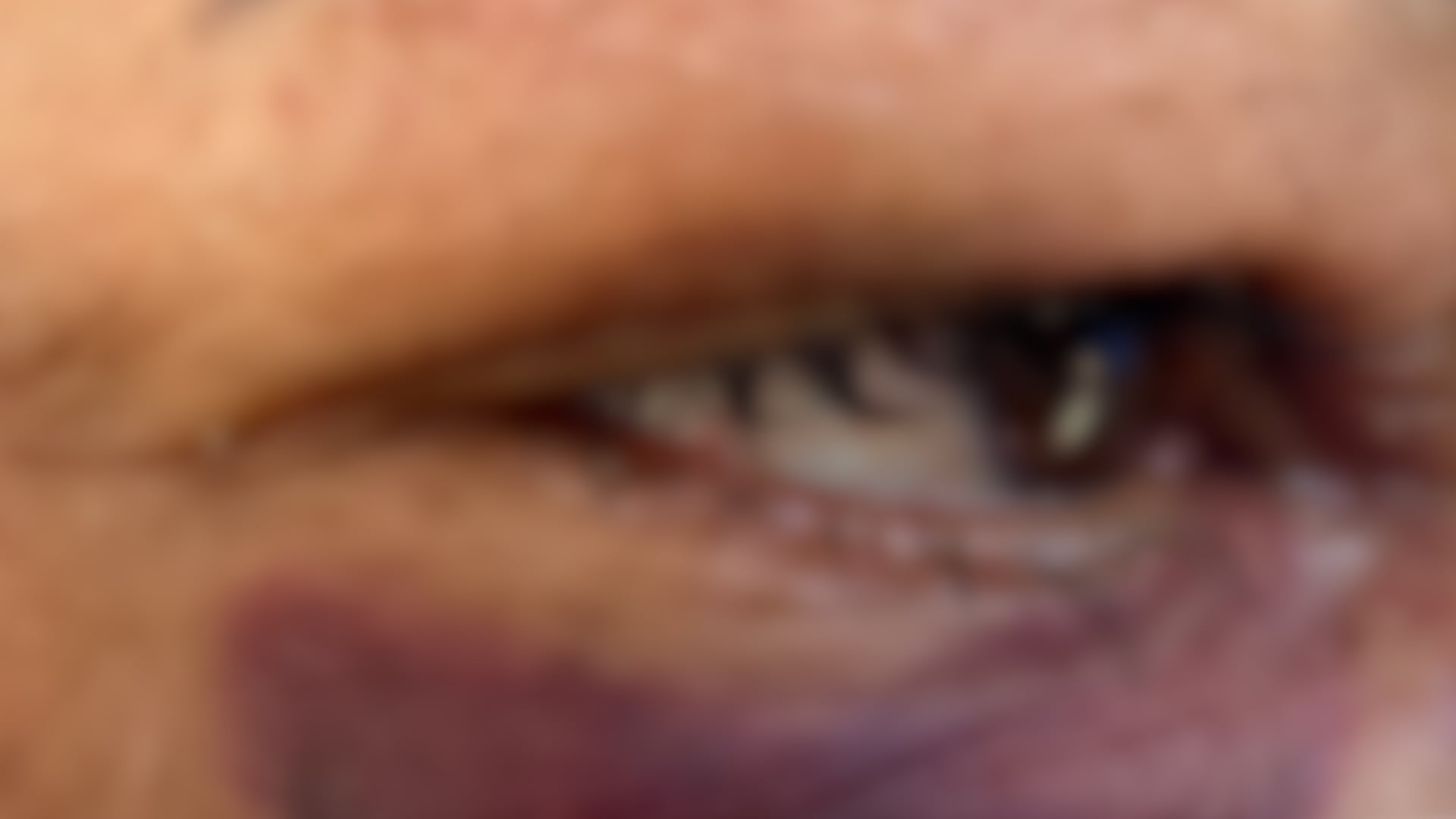 Mulher tem a mandíbula quebrada após ser espancada pelo namorado Mulher tem a mandíbula quebrada após ser espancada pelo namorado