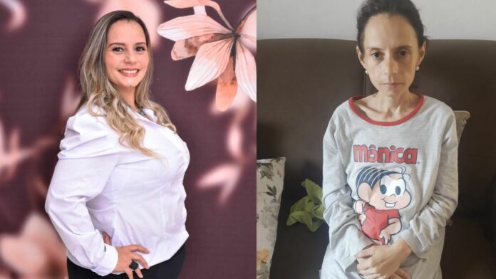 Mulher faz bariátrica e chega a ter anemia devido a magreza extrema: 
