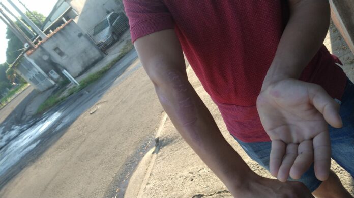 Na avenida Campos Sales no Bairro Vila Frezzarin em Americana um motoboy se feriu ao cai de moto depois de se enroscar em fios soltos. Na avenida Campos Sales no Bairro Vila Frezzarin em Americana um motoboy se feriu ao cai de moto depois de se enroscar em fios soltos.