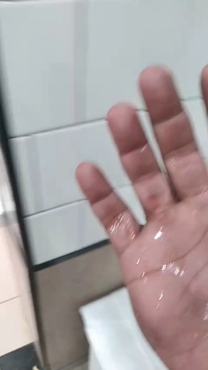 Motoboy é agredido com óleo quente por atendente de fast food Motoboy é agredido com óleo quente por atendente de fast food