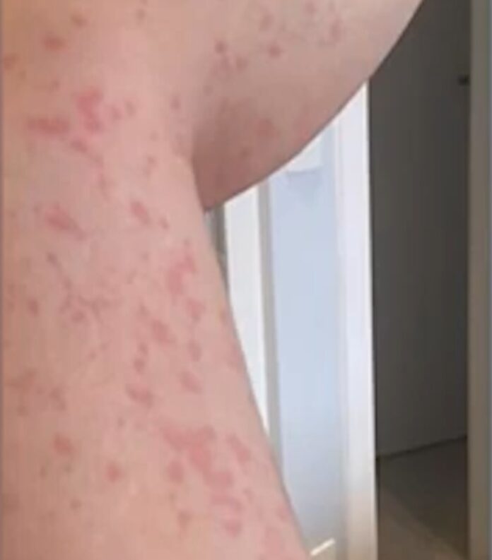 Só esse ano já foram registrados 15 casos Só esse ano já foram registrados 15 casos