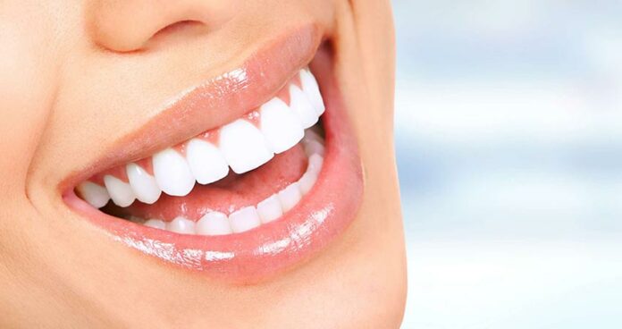 lentes-de-contato-dental-ou-clareamento-qual-e-a-melhor-opcao