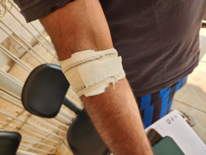 WhatsApp Image 2024-09-13 at 12.05.50 Morador de rua foragido invade casa e morde braço da vítima em Limeira