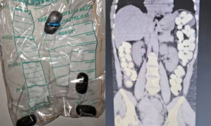 mulher ingere cápsulas com drogas