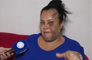 VÍTIMA ESFAQUEIA PLANALTO Vítima de tentativa de feminicídio em Piracicaba tem alta e fala pela primeira vez: