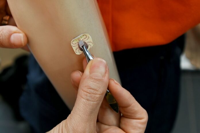 Campinas confirma mais um caso de febre maculosa: idosa sobreviveu