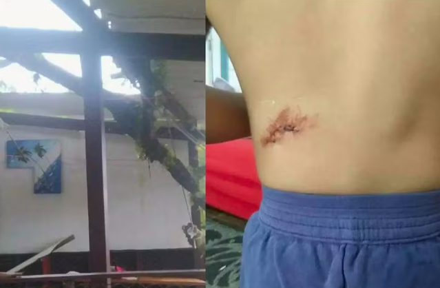 criança ferida guarujá