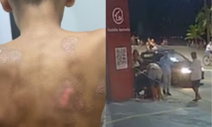 criança atropelada pg