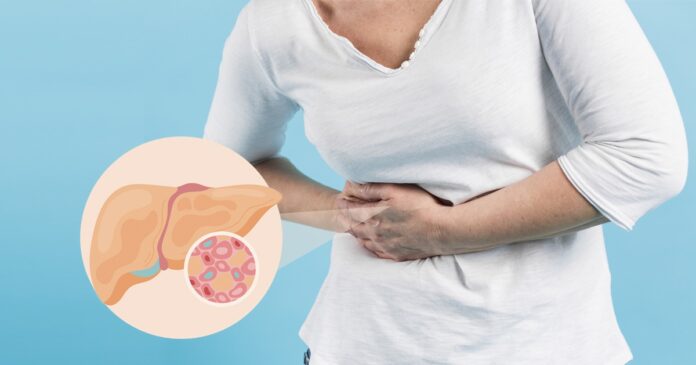 Gordura no fígado pode dobrar risco de morte, alerta estudo sueco