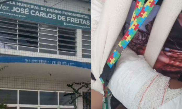 menina autista agressão mongaguá