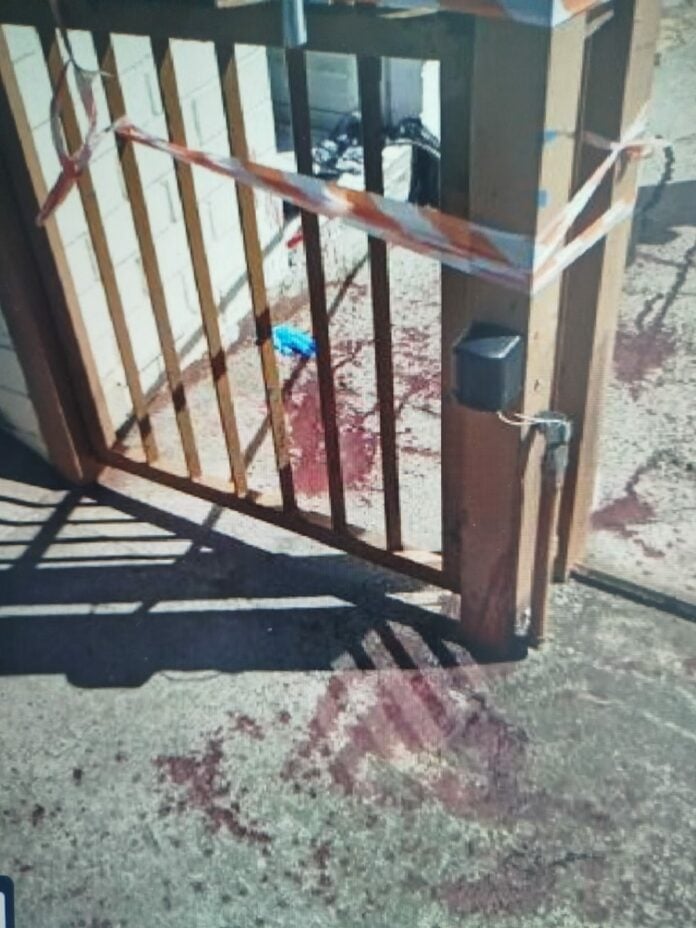 Mulher é atacada com golpes de tesoura pelo ex-marido em São José dos Campos Mulher é atacada com golpes de tesoura pelo ex-marido em São José dos Campos '