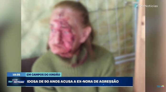 Idosa de 90 anos acusa ex-nora de agressão com chave de fenda em Campos do Jordão Idosa de 90 anos acusa ex-nora de agressão com chave de fenda em Campos do Jordão