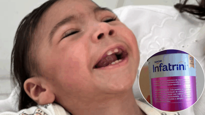 Crianças com necessidades especiais ficam sem leite medicinal em Sumaré Crianças com necessidades especiais ficam sem leite medicinal em Sumaré