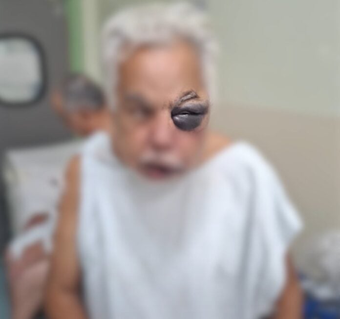 VÍDEO: Homem é preso após espancar idoso de 70 anos em São José