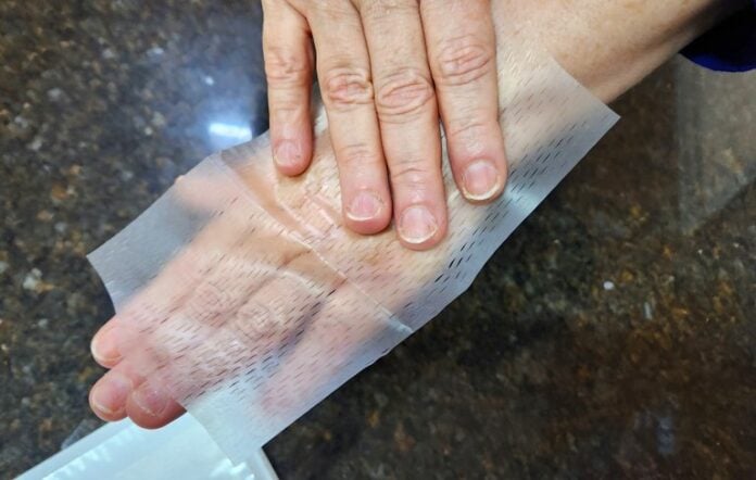 Protocolo acelera cicatrização de feridas no Hospital do Servidor General Edson Ramalho