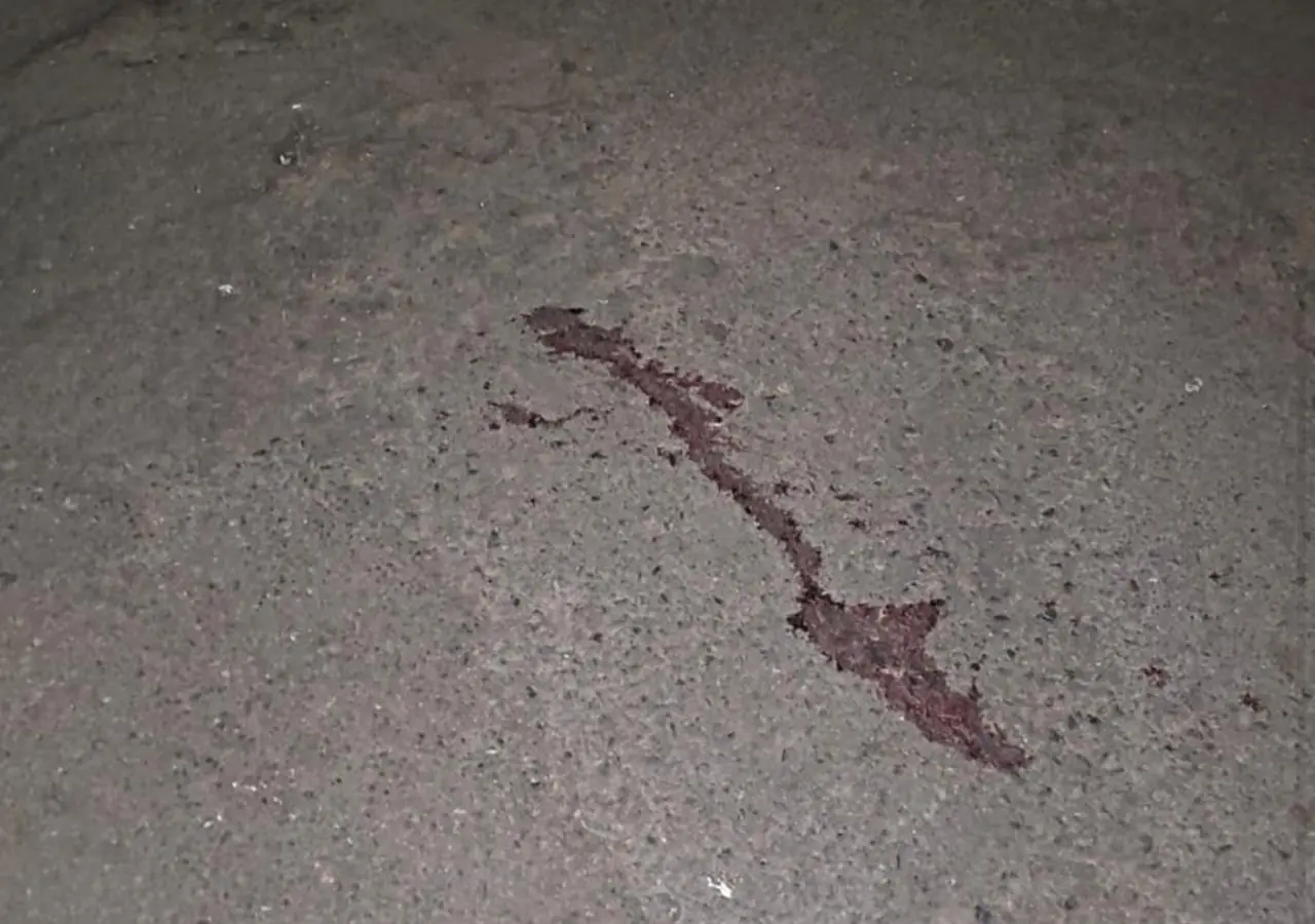 Jovem sobrevive a tiros na cabeça e ajuda polícia a prender suspeitos